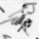 Image for article titled This Ebola-Type Fever is Named After a Town in Germany
